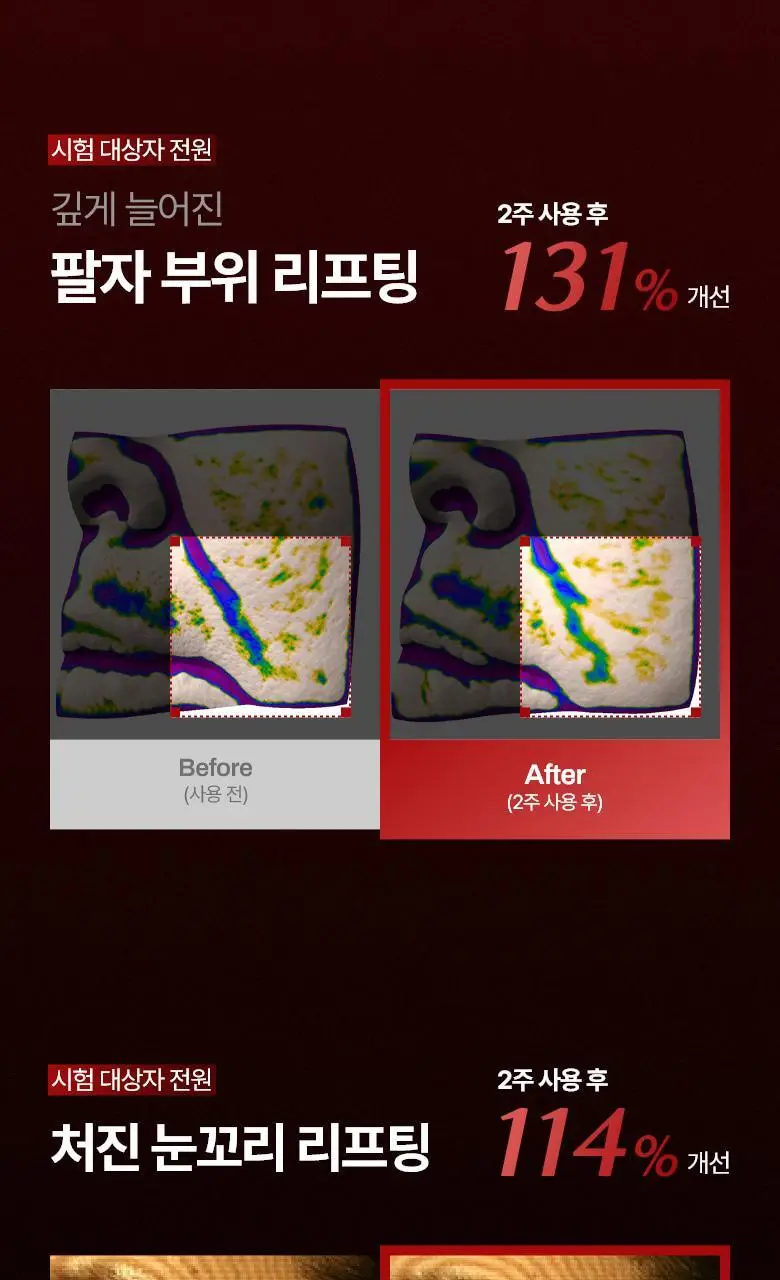 [탄력 리프팅] 메디테라피 링클핏 마스크 7매입 상세페이지 7